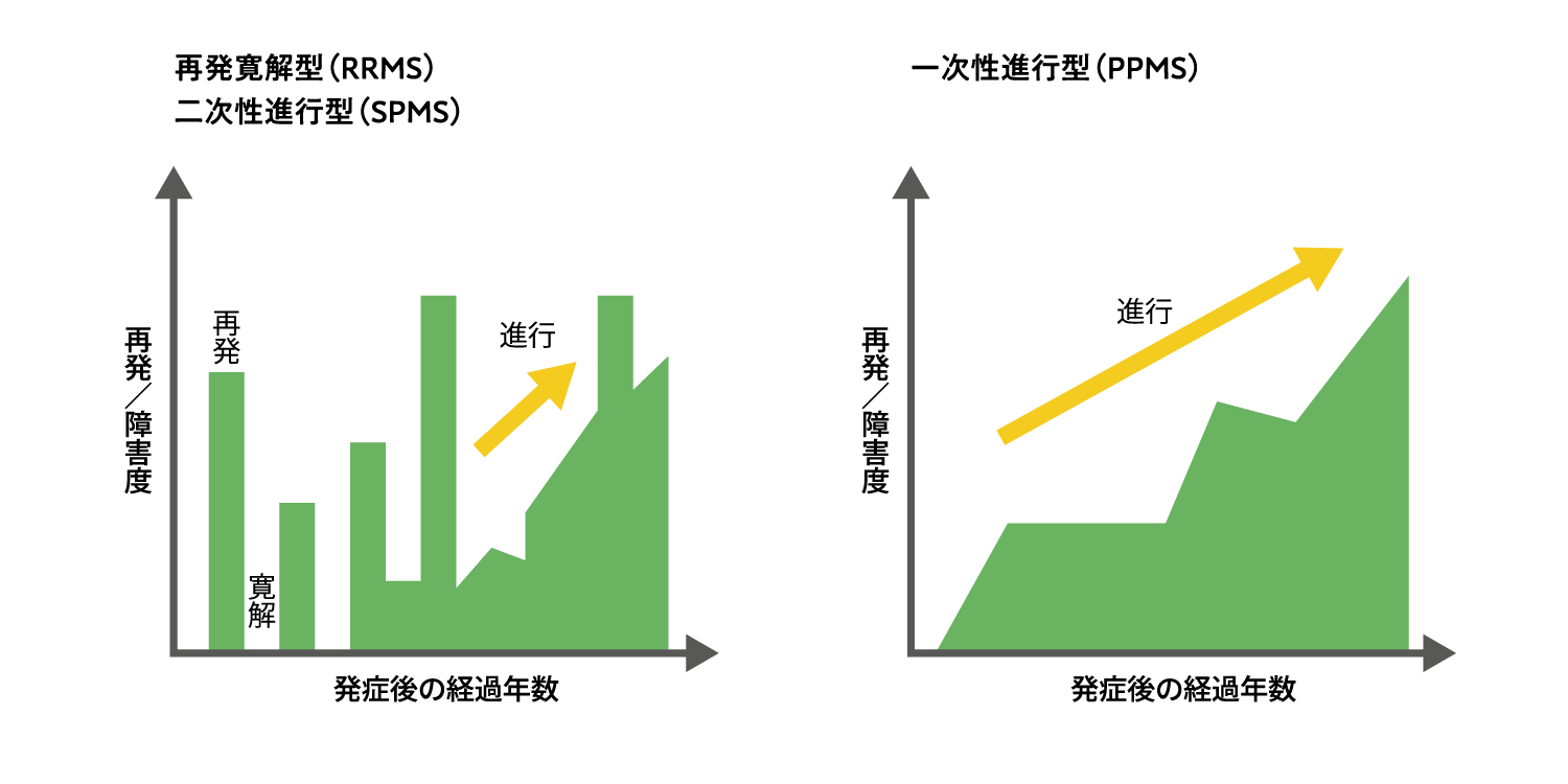 MSの経過：病型別（イメージ図）