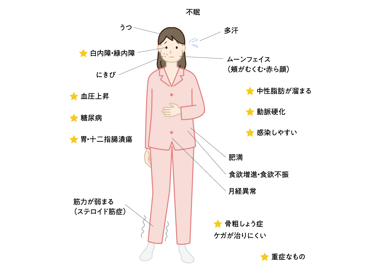 GC(ステロイド)剤の副作用